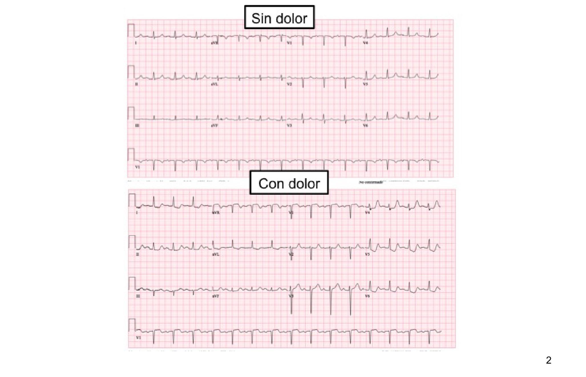 Imagen clínica de la pregunta de Cardiología