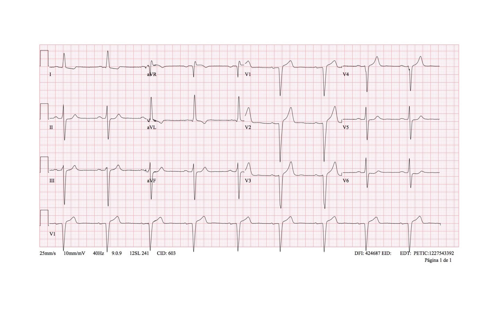 Imagen clínica de la pregunta de Cardiología