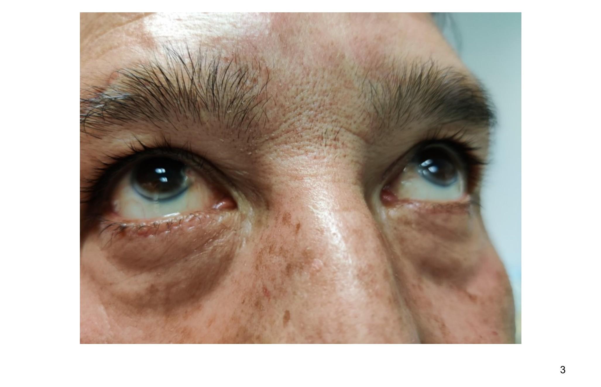 Imagen clínica de la pregunta de Cardiología
