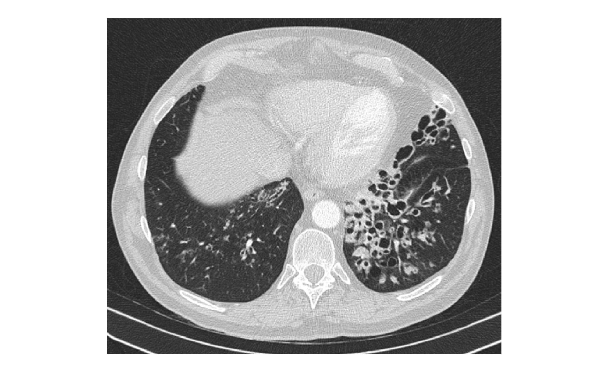 Imagen clínica de la pregunta de Respiratorio