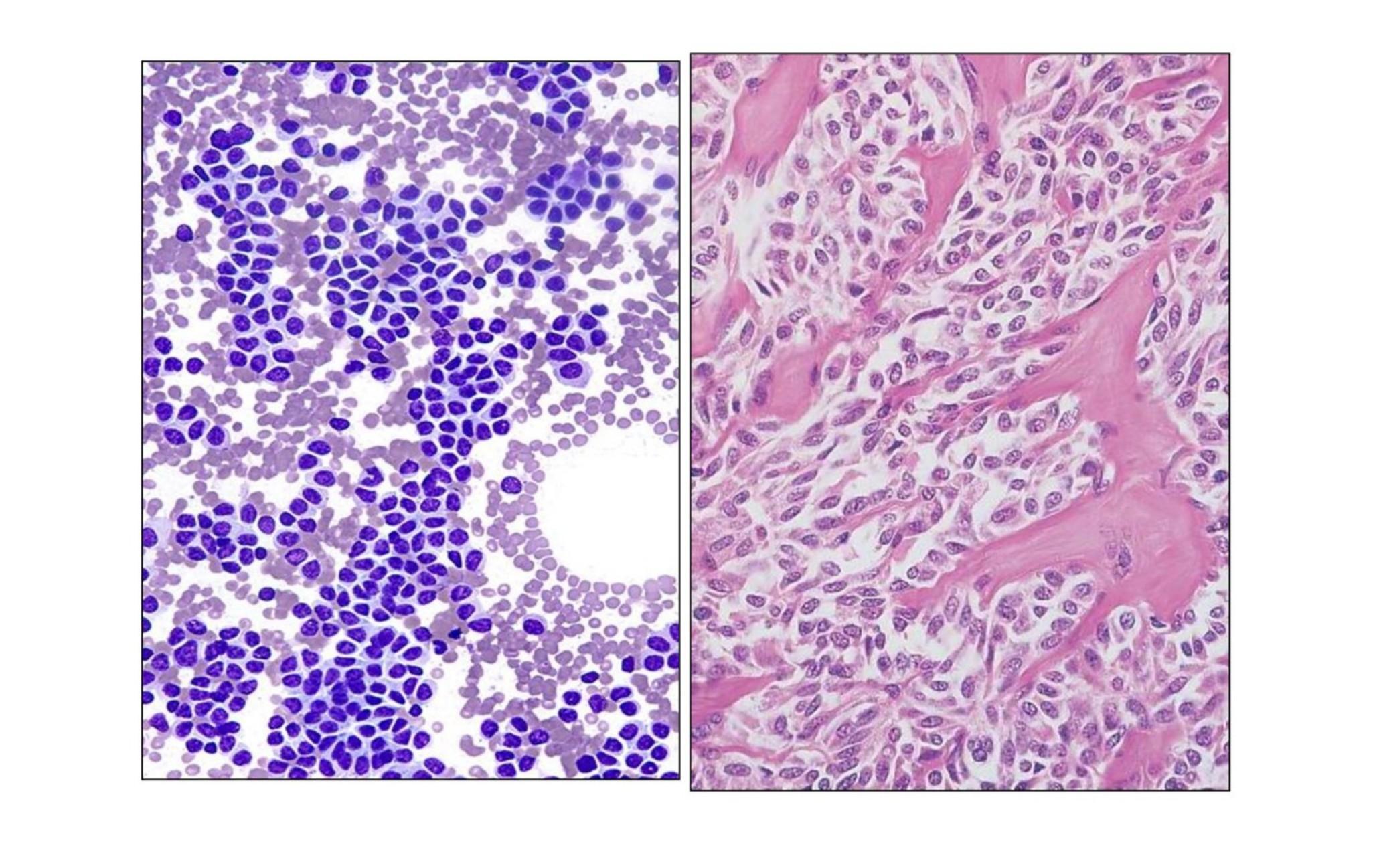 Imagen clínica de la pregunta de Oncología