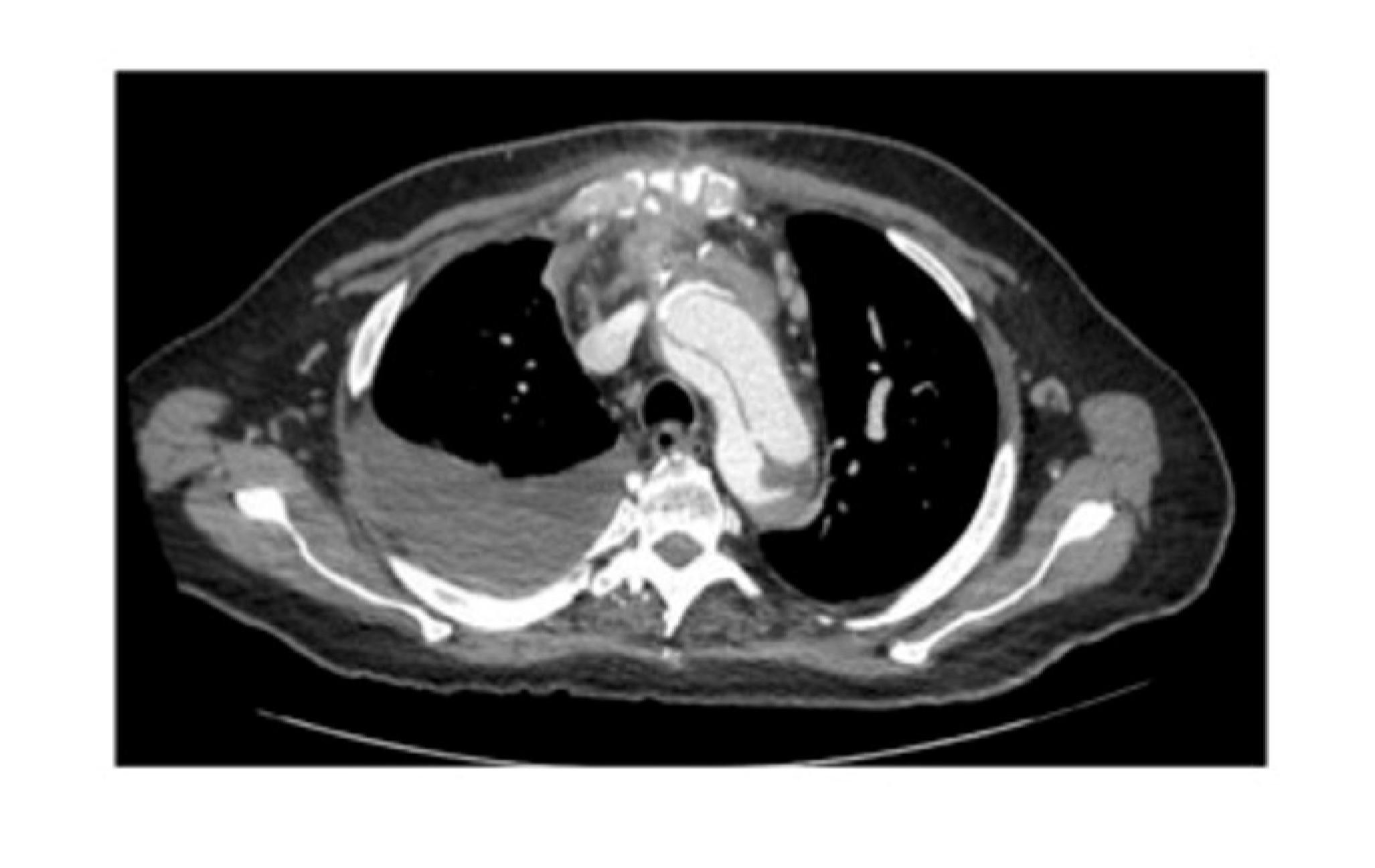 Imagen clínica de la pregunta de Cardiología