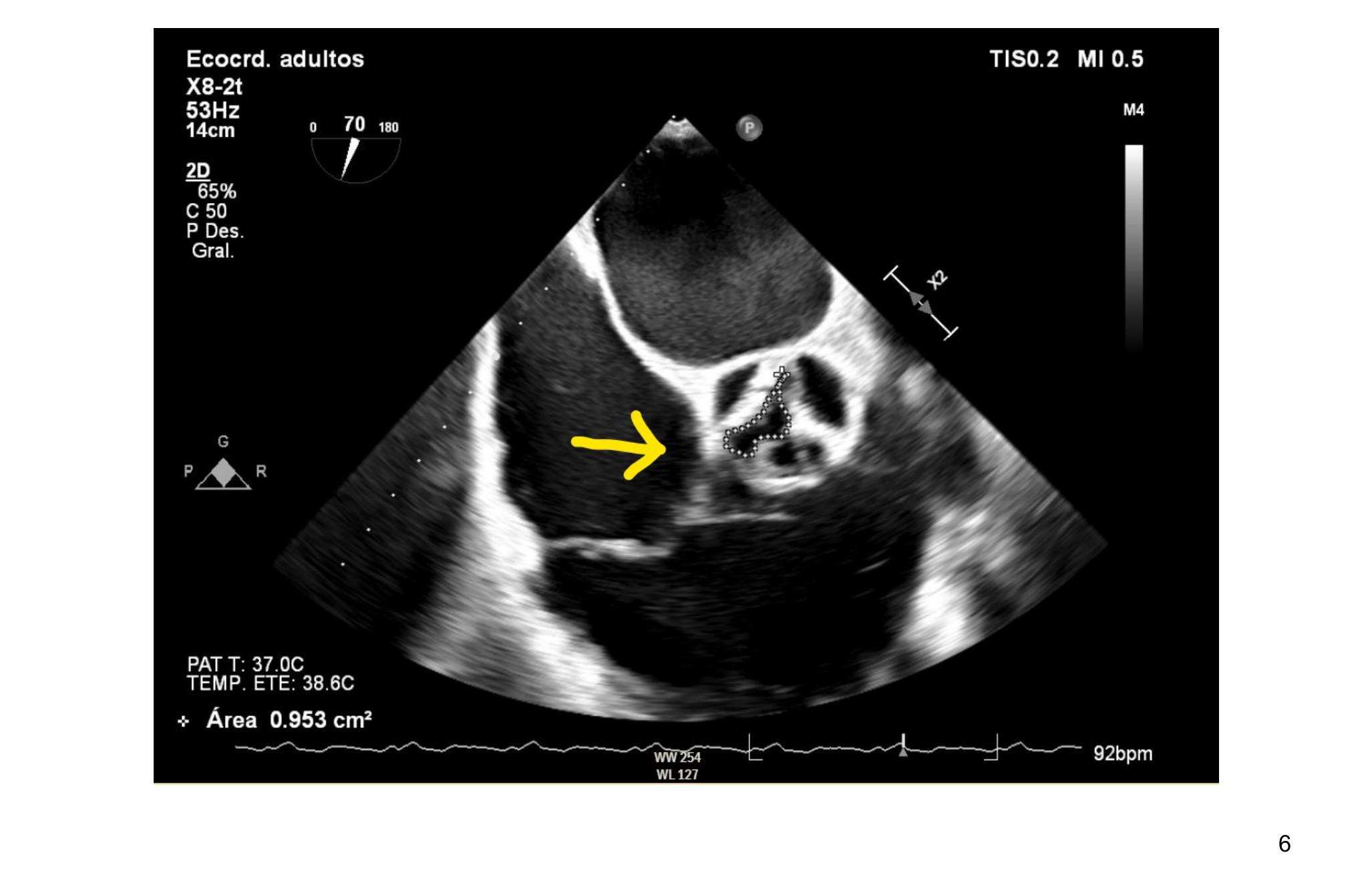 Imagen clínica de la pregunta de Cardiología