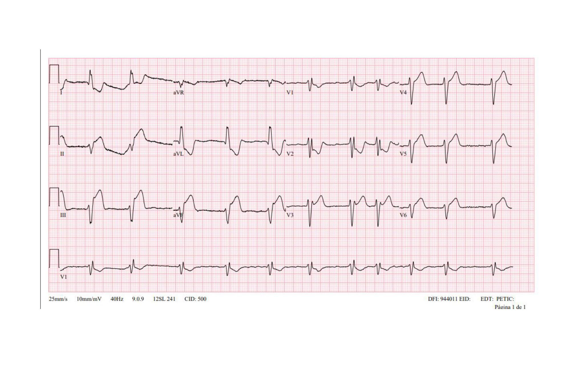 Imagen clínica de la pregunta de Cardiología