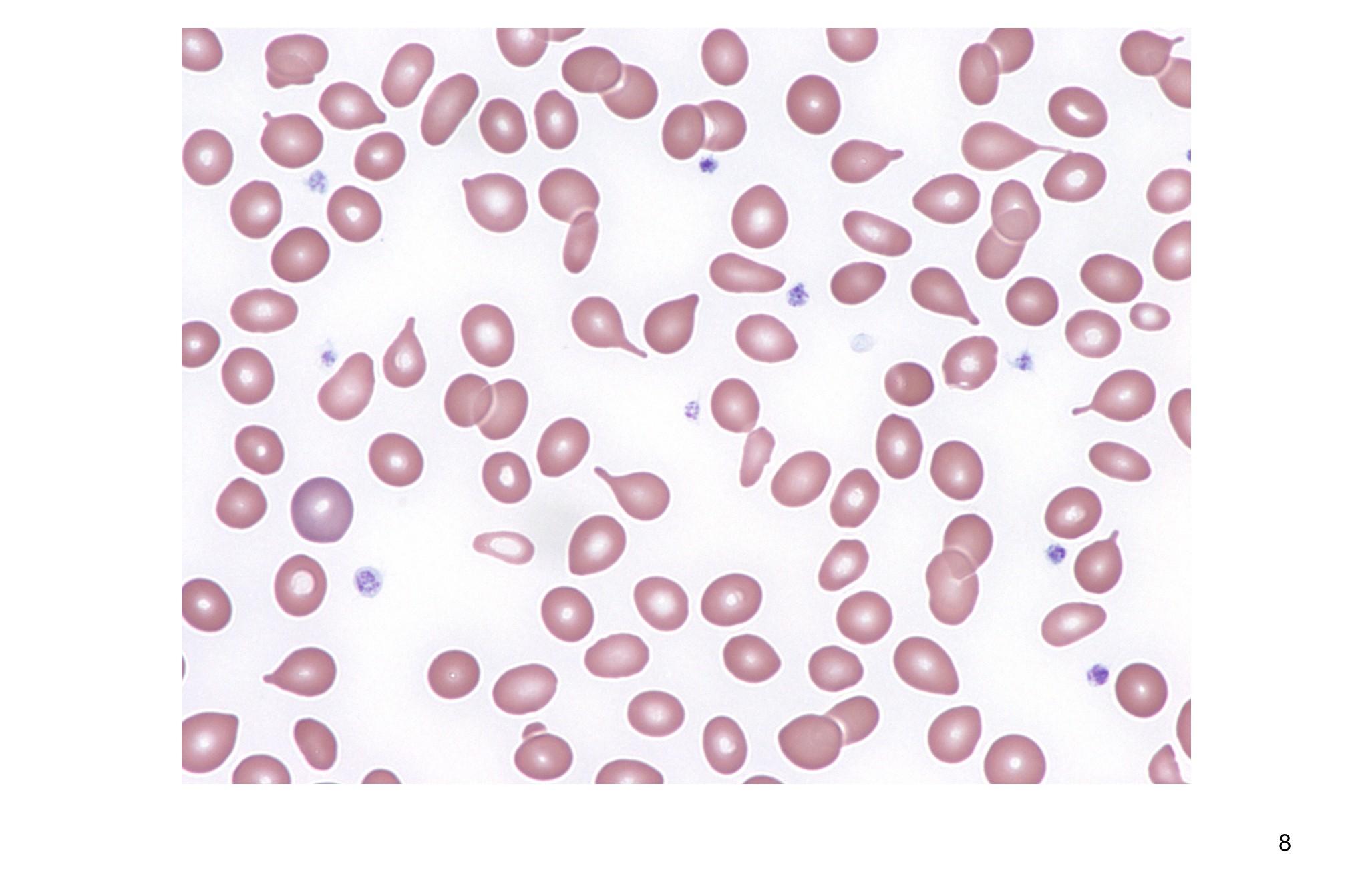 Imagen clínica de la pregunta de Hematología
