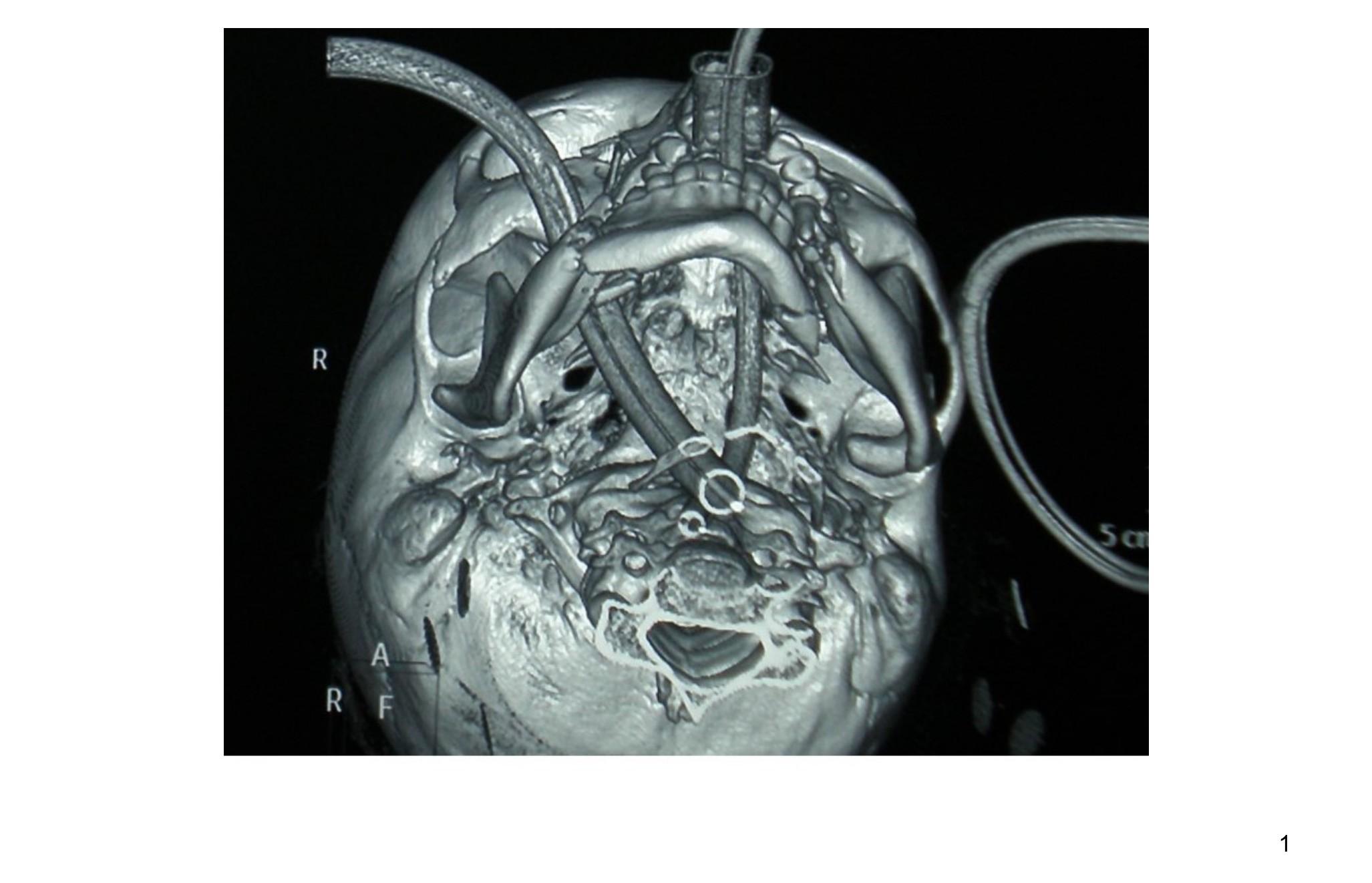 Imagen clínica de la pregunta de Traumatología