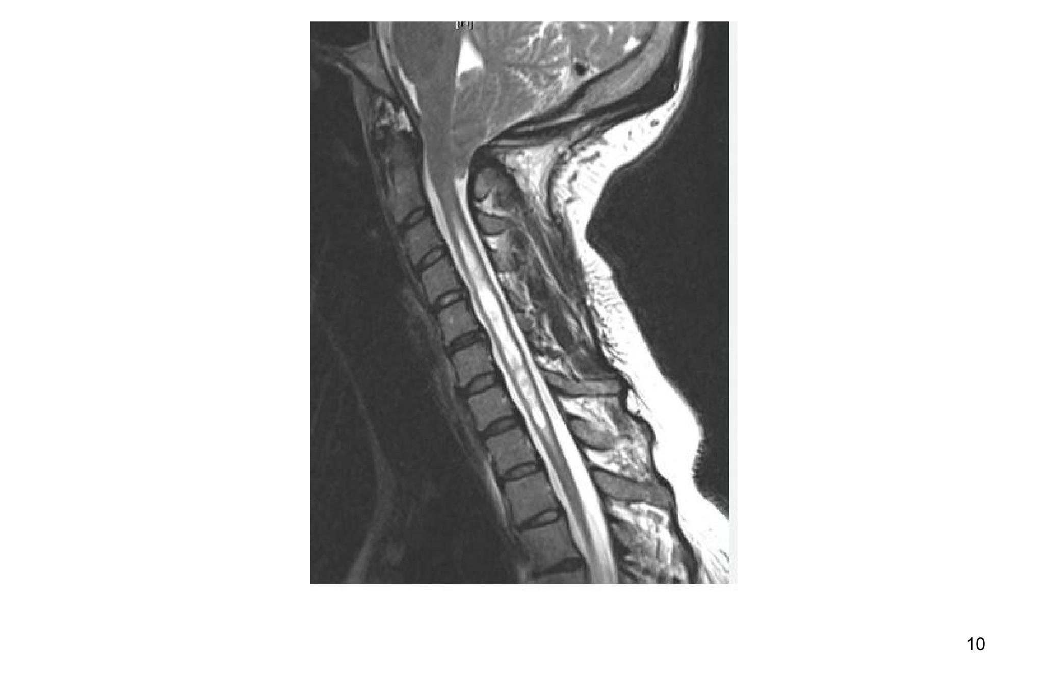 Imagen clínica de la pregunta de Neurología