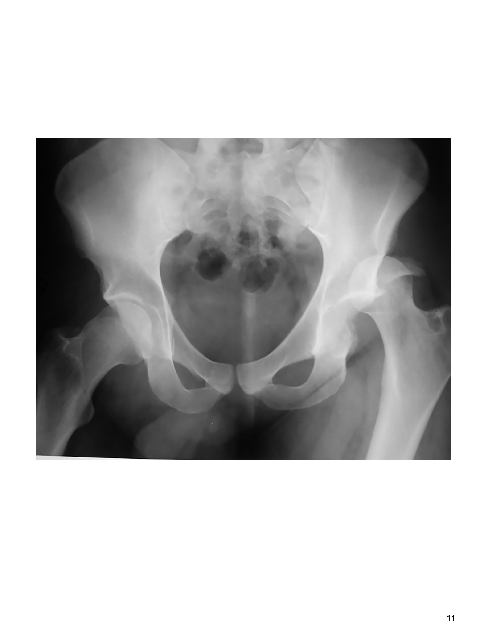 Imagen clínica de la pregunta de Traumatología