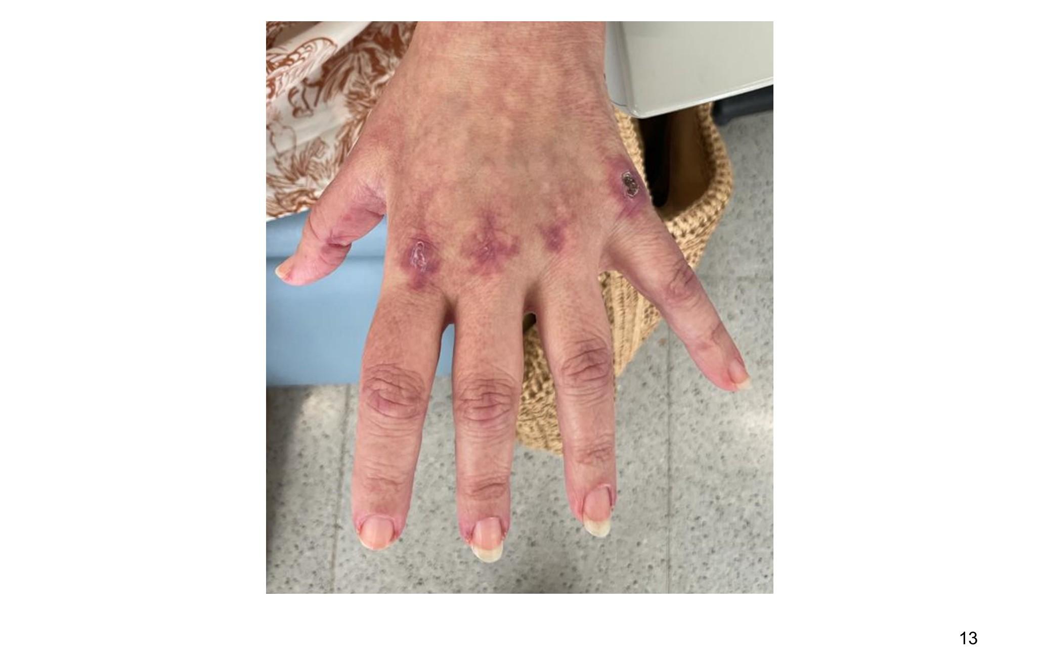 Imagen clínica de la pregunta de Hematología