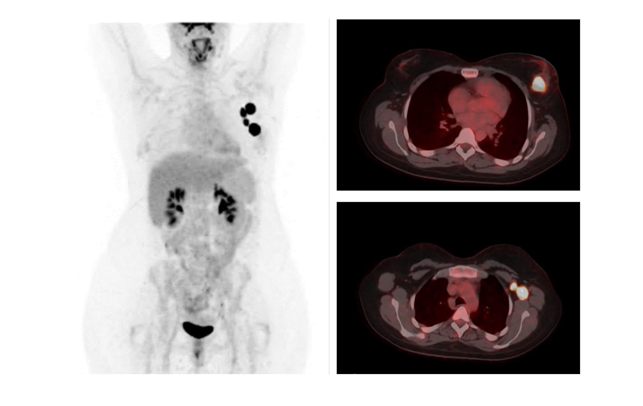 Imagen clínica de la pregunta de Oncología