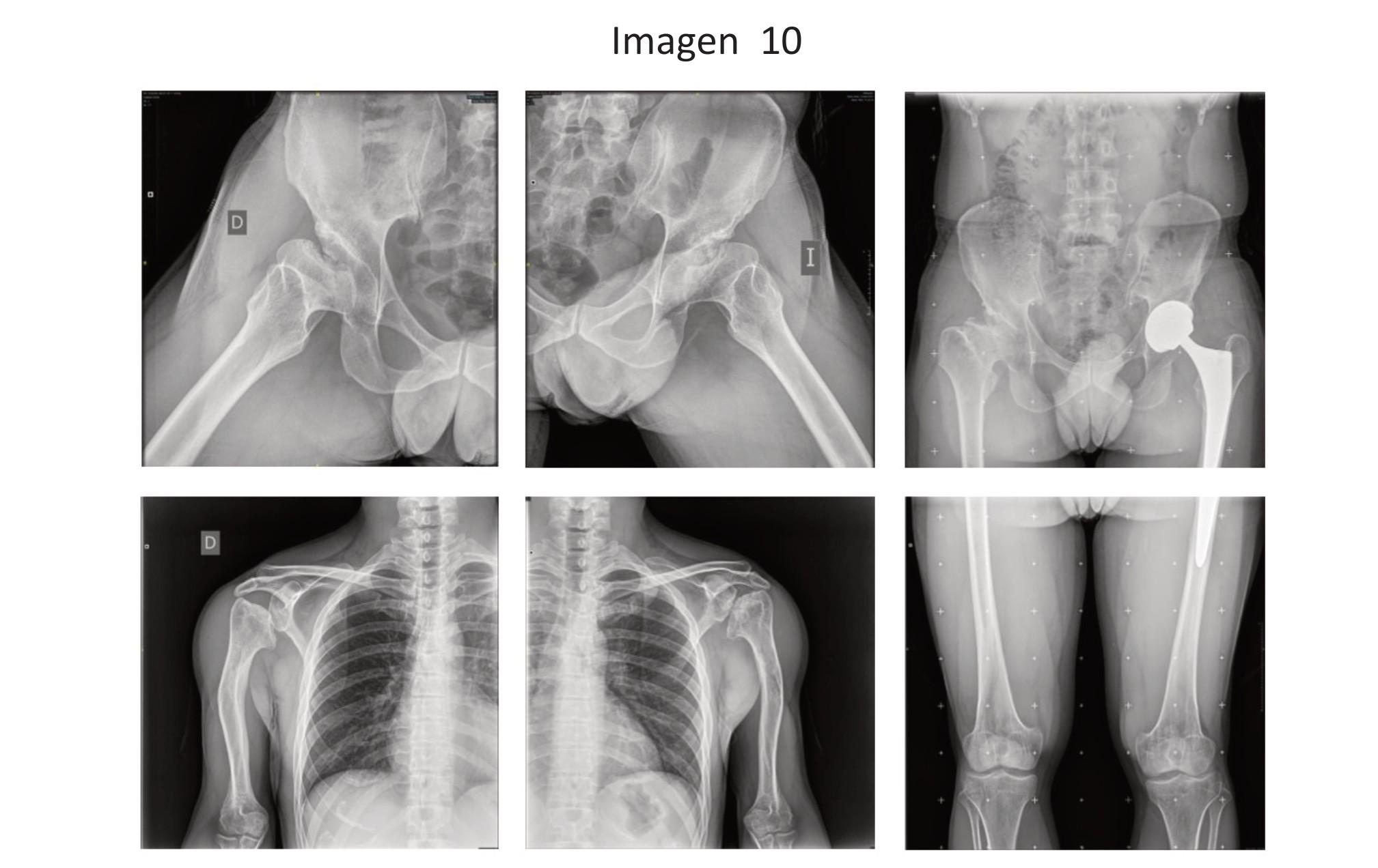 Imagen clínica de la pregunta de Pediatría