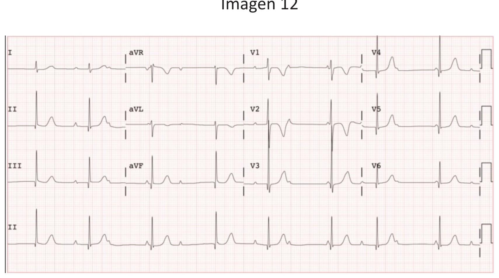 Imagen clínica de la pregunta de Cardiología