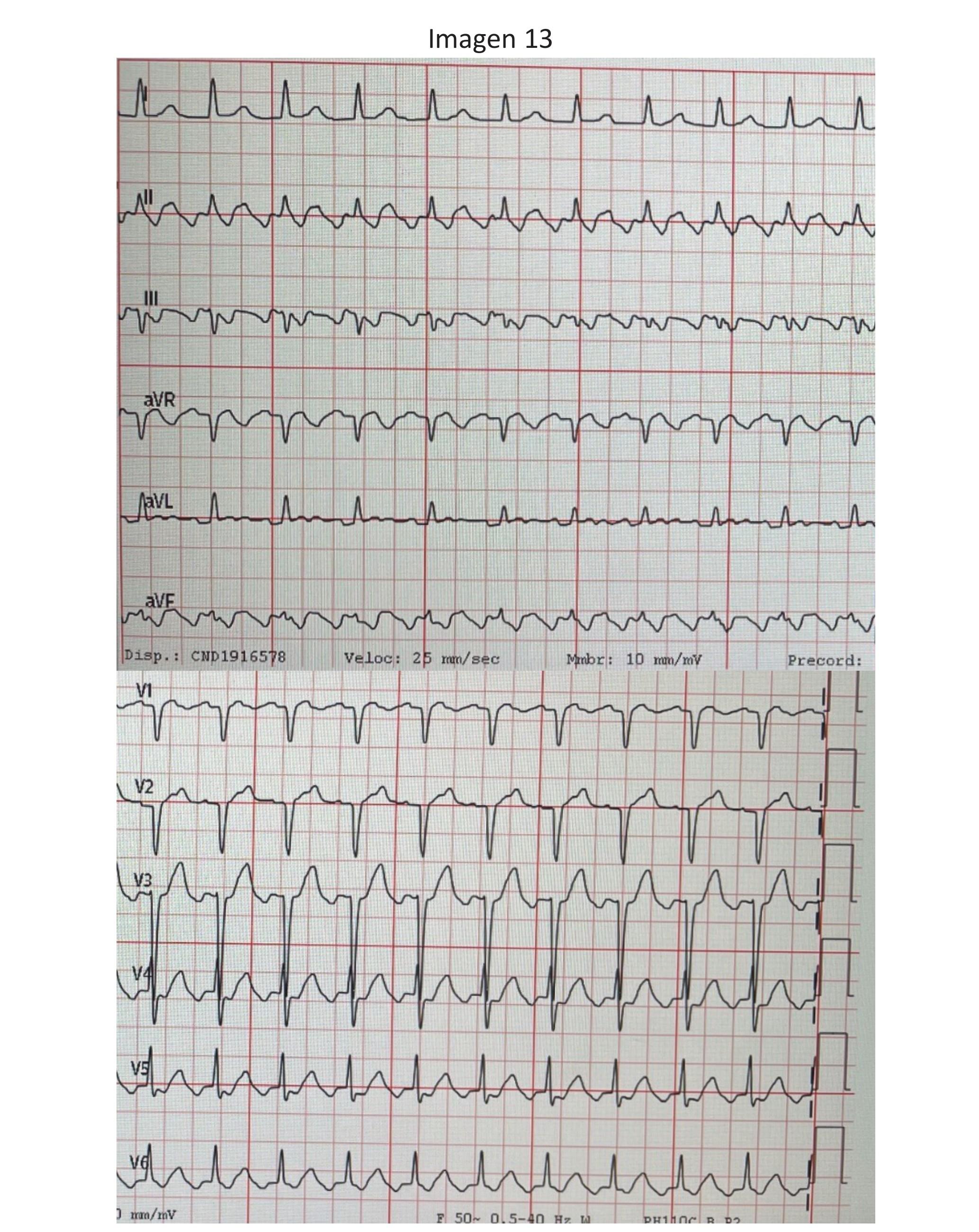 Imagen clínica de la pregunta de Cardiología