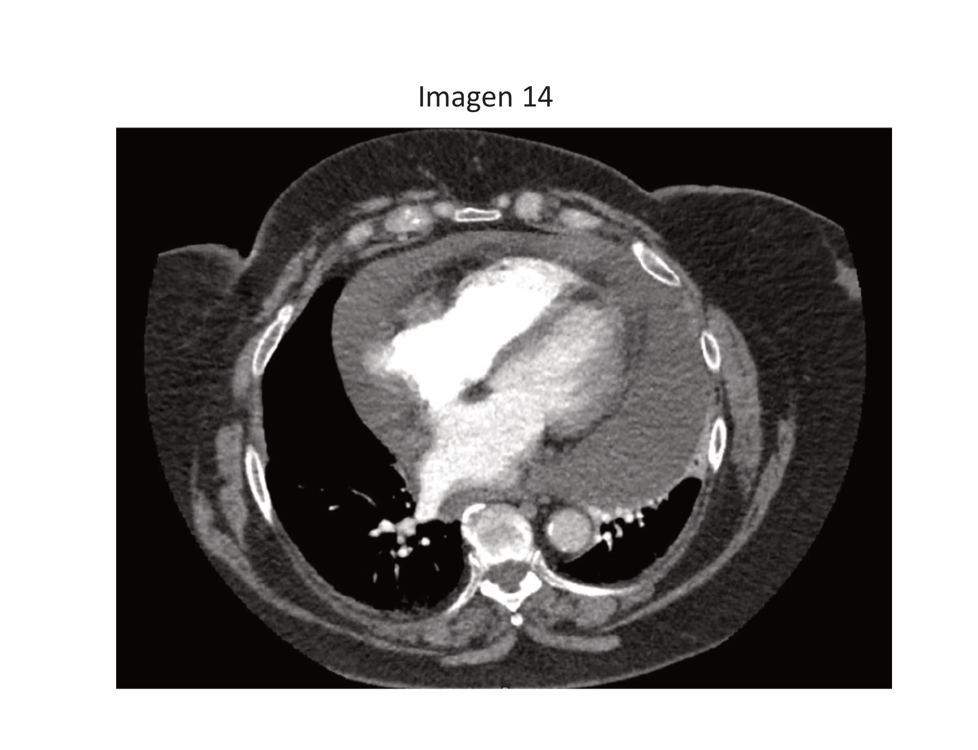 Imagen clínica de la pregunta de Respiratorio
