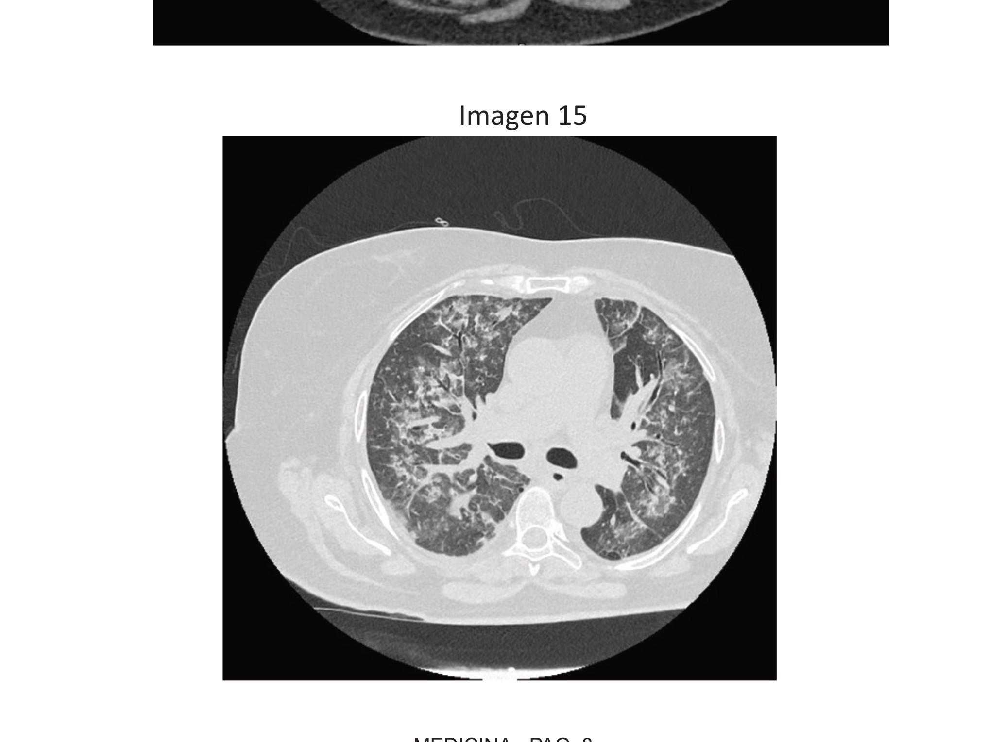 Imagen clínica de la pregunta de Nefrología
