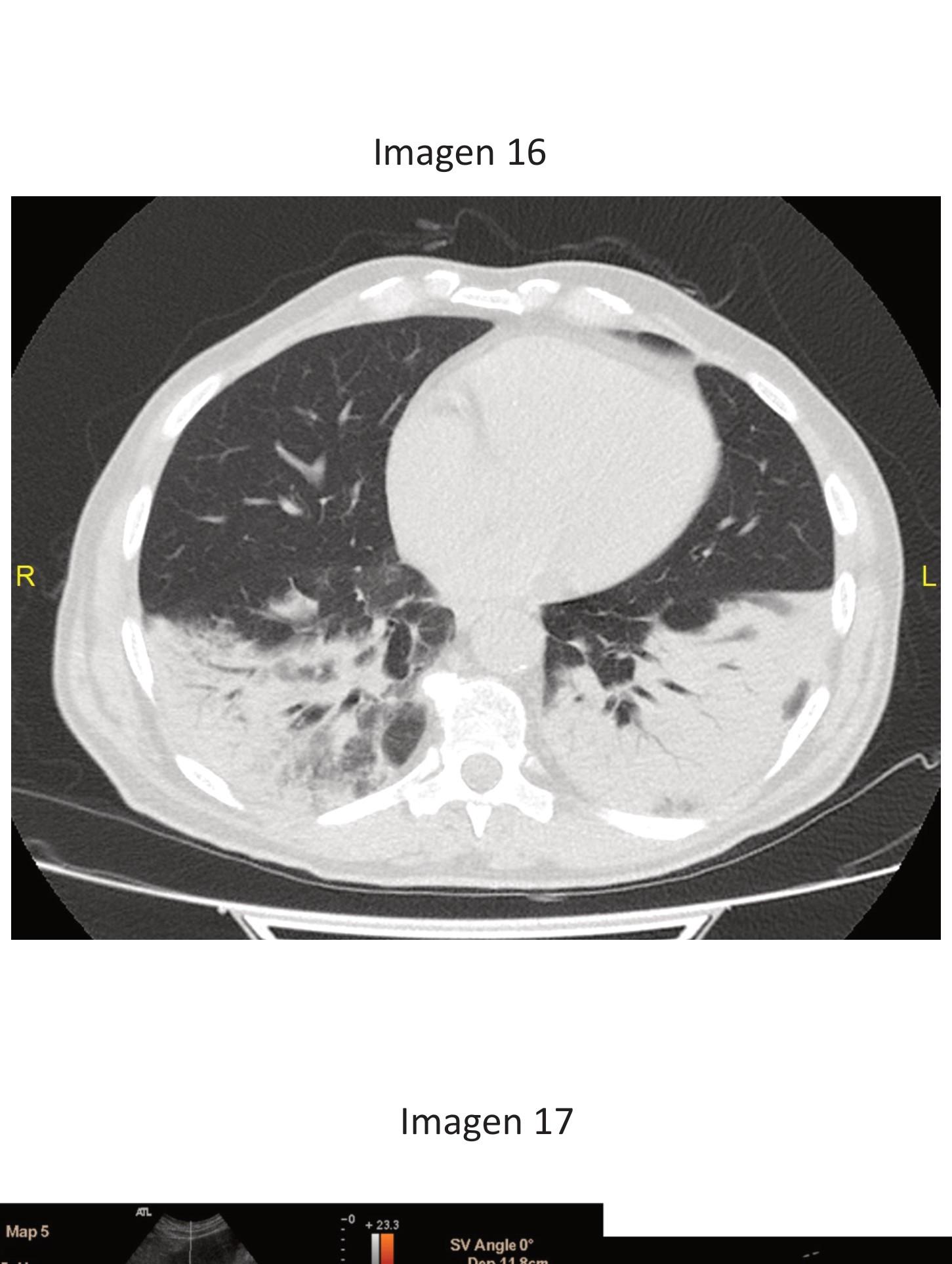 Imagen clínica de la pregunta de Respiratorio