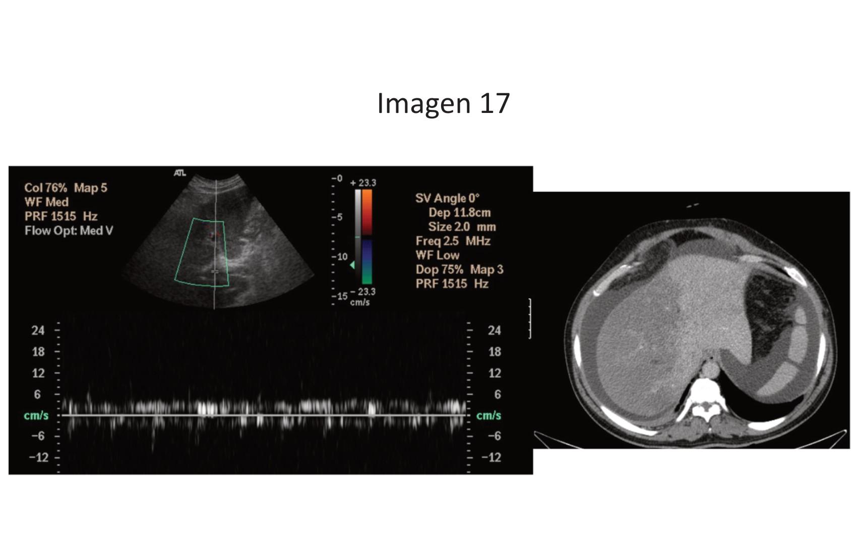 Imagen clínica de la pregunta de Cardiología