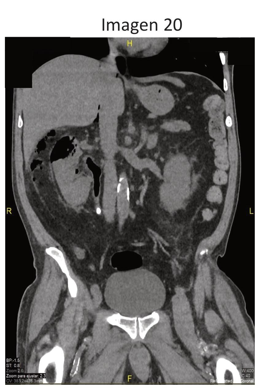Imagen clínica de la pregunta de Endocrinología