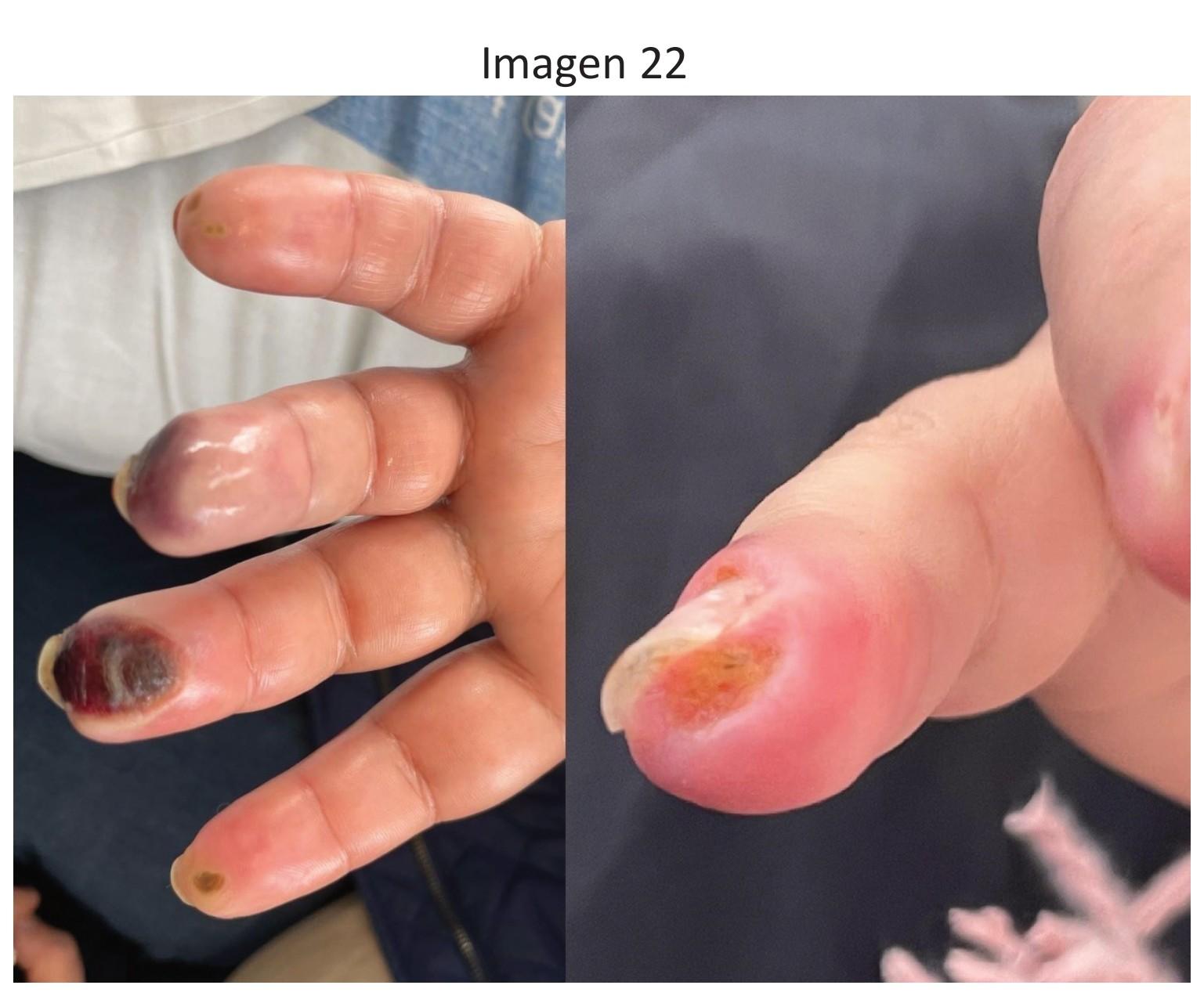 Imagen clínica de la pregunta de Urgencias