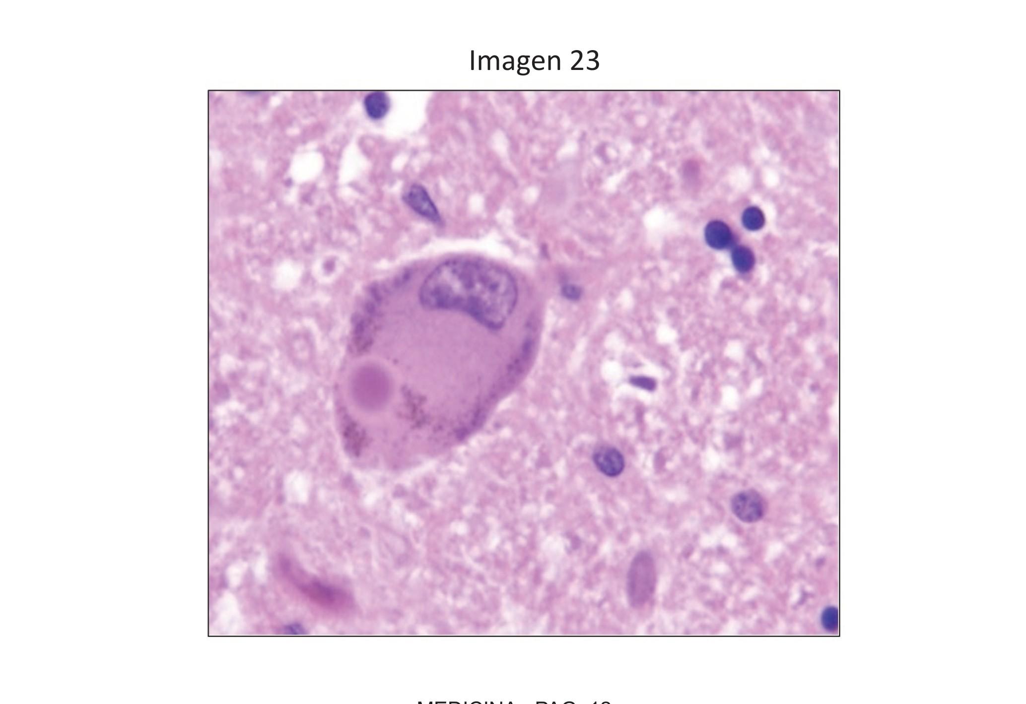 Imagen clínica de la pregunta de Neurología