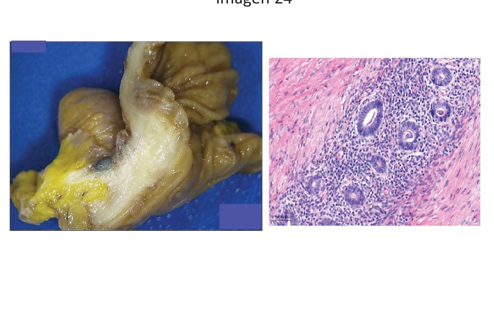 Imagen clínica de la pregunta de Oncología