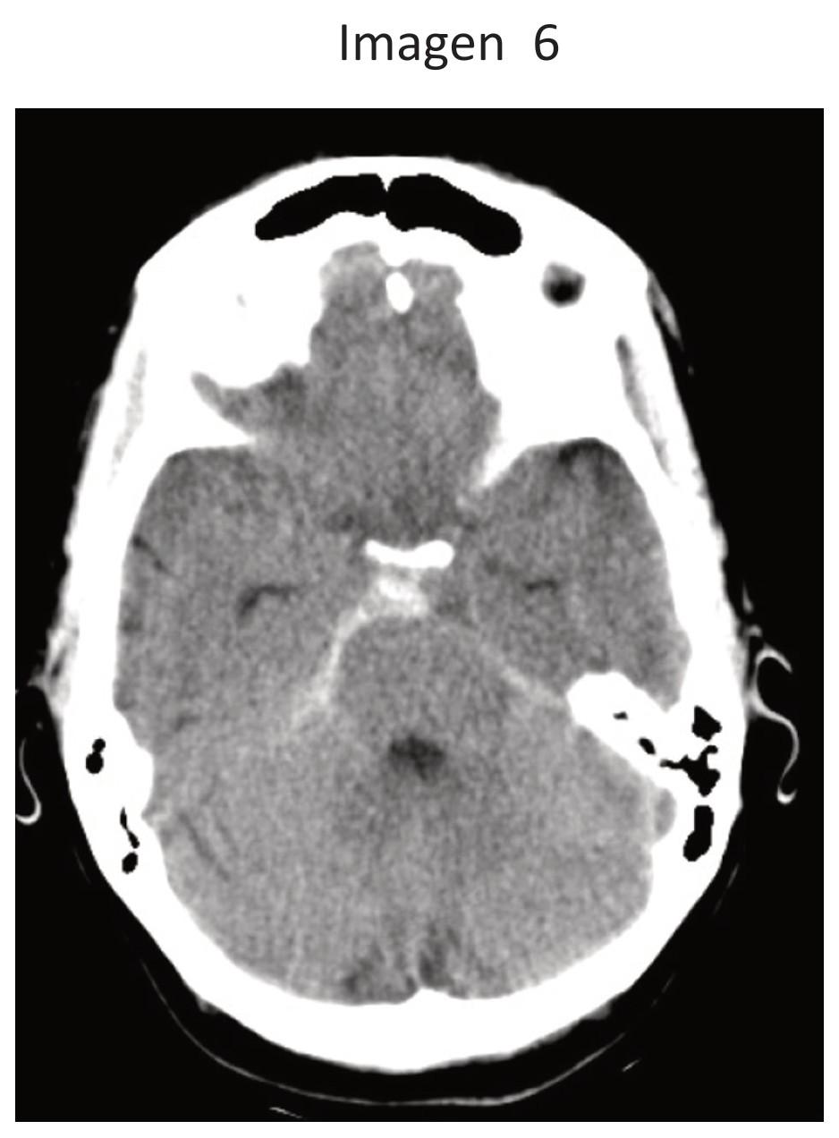 Imagen clínica de la pregunta de Neurología