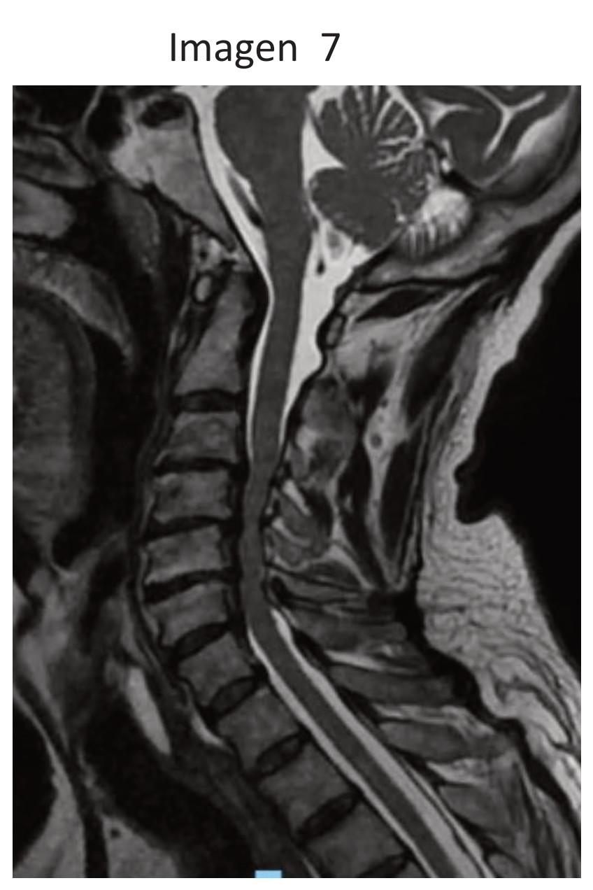 Imagen clínica de la pregunta de Neurología