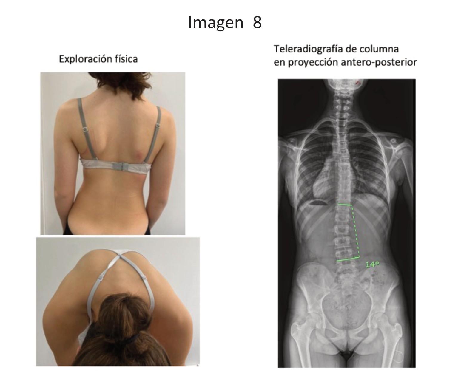 Imagen clínica de la pregunta de Traumatología