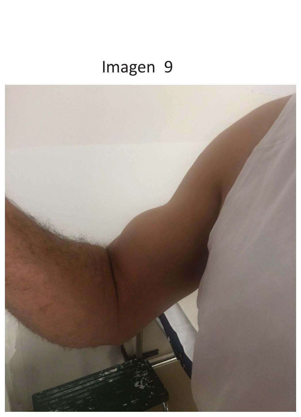 Imagen clínica de la pregunta de Traumatología