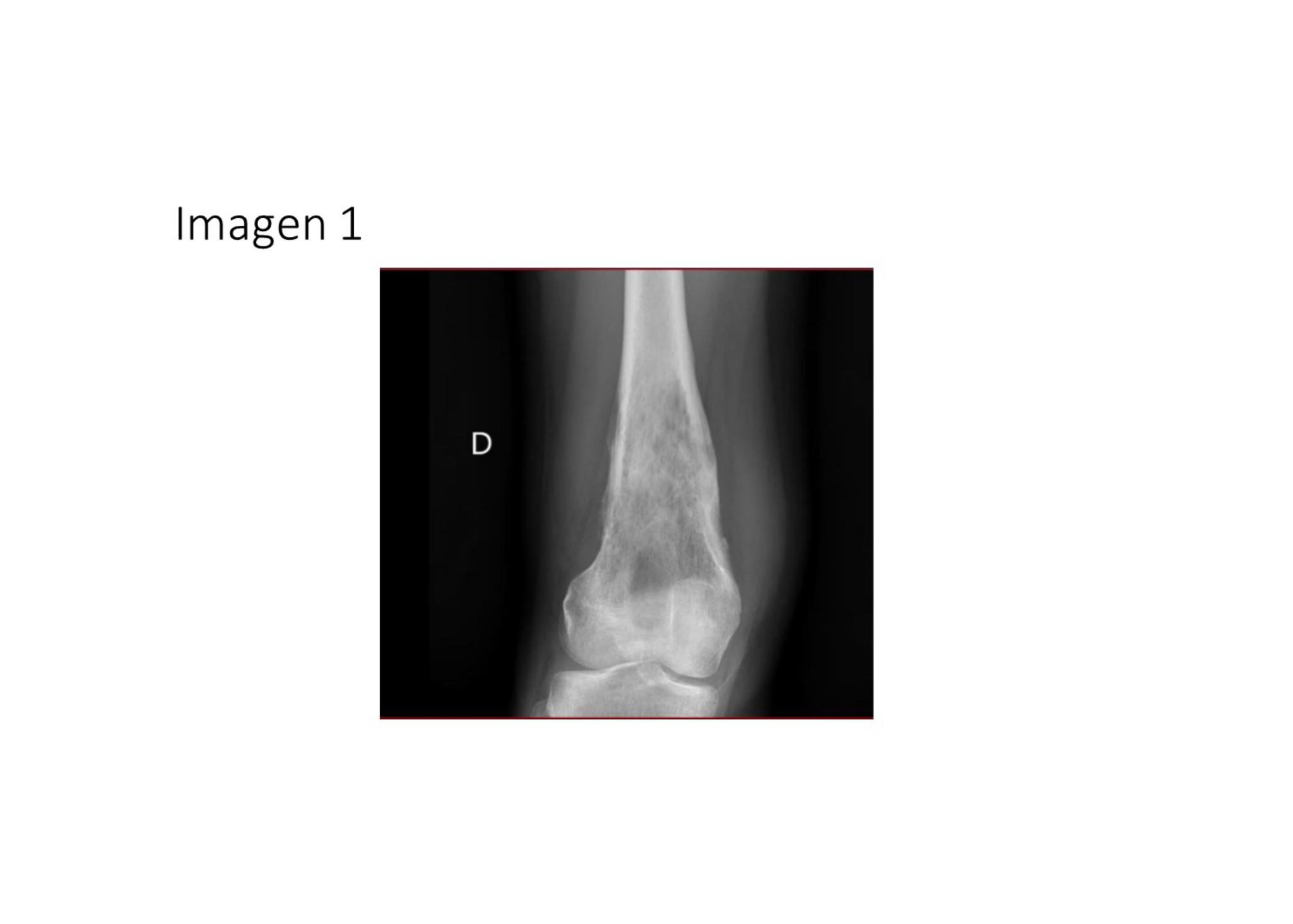 Imagen clínica de la pregunta de Traumatología