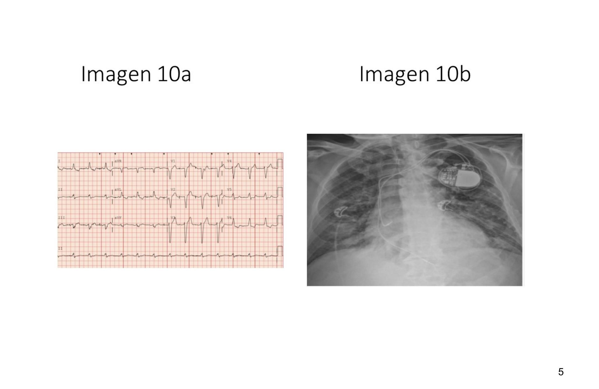 Imagen clínica de la pregunta de Cardiología