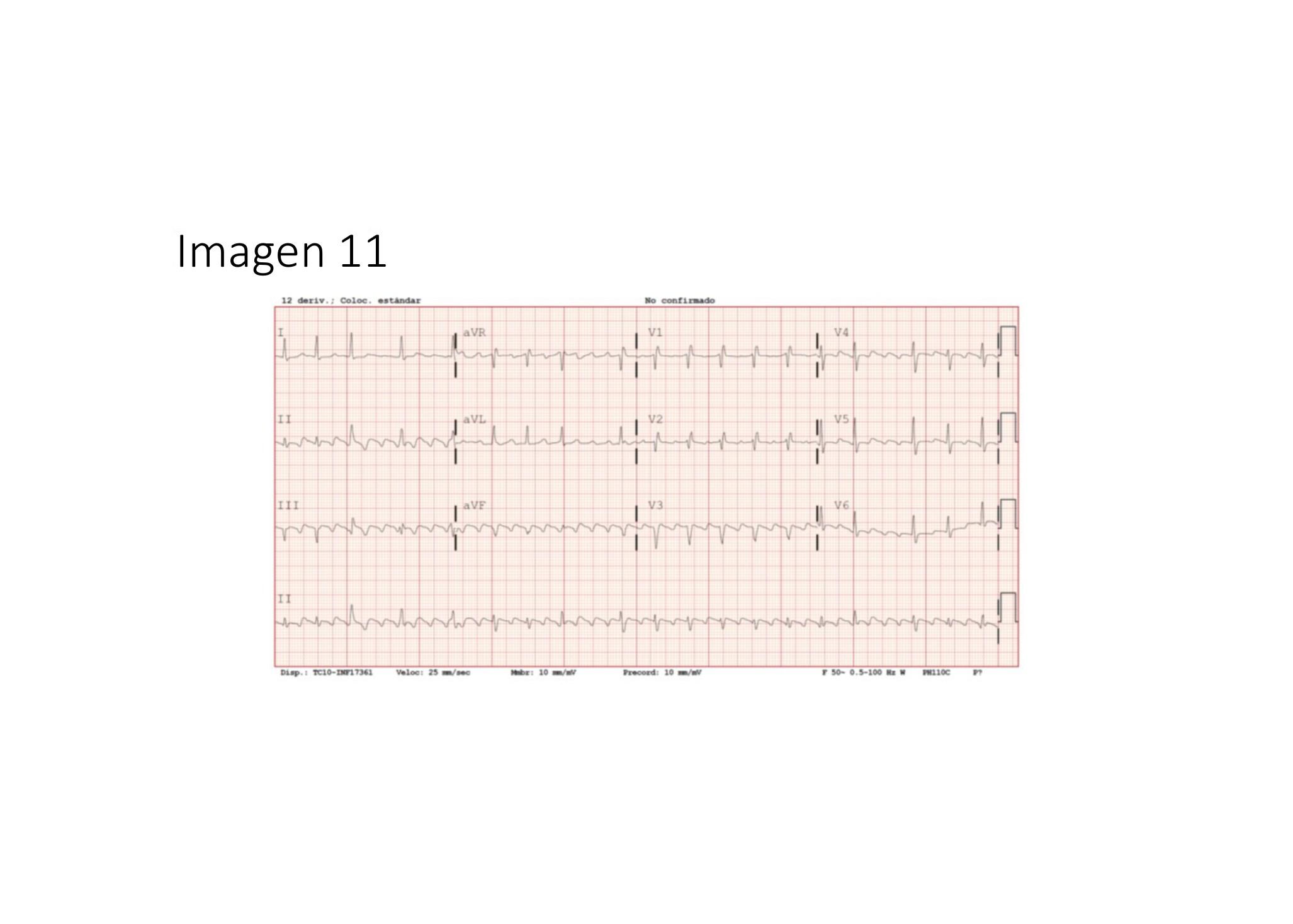 Imagen clínica de la pregunta de Cardiología