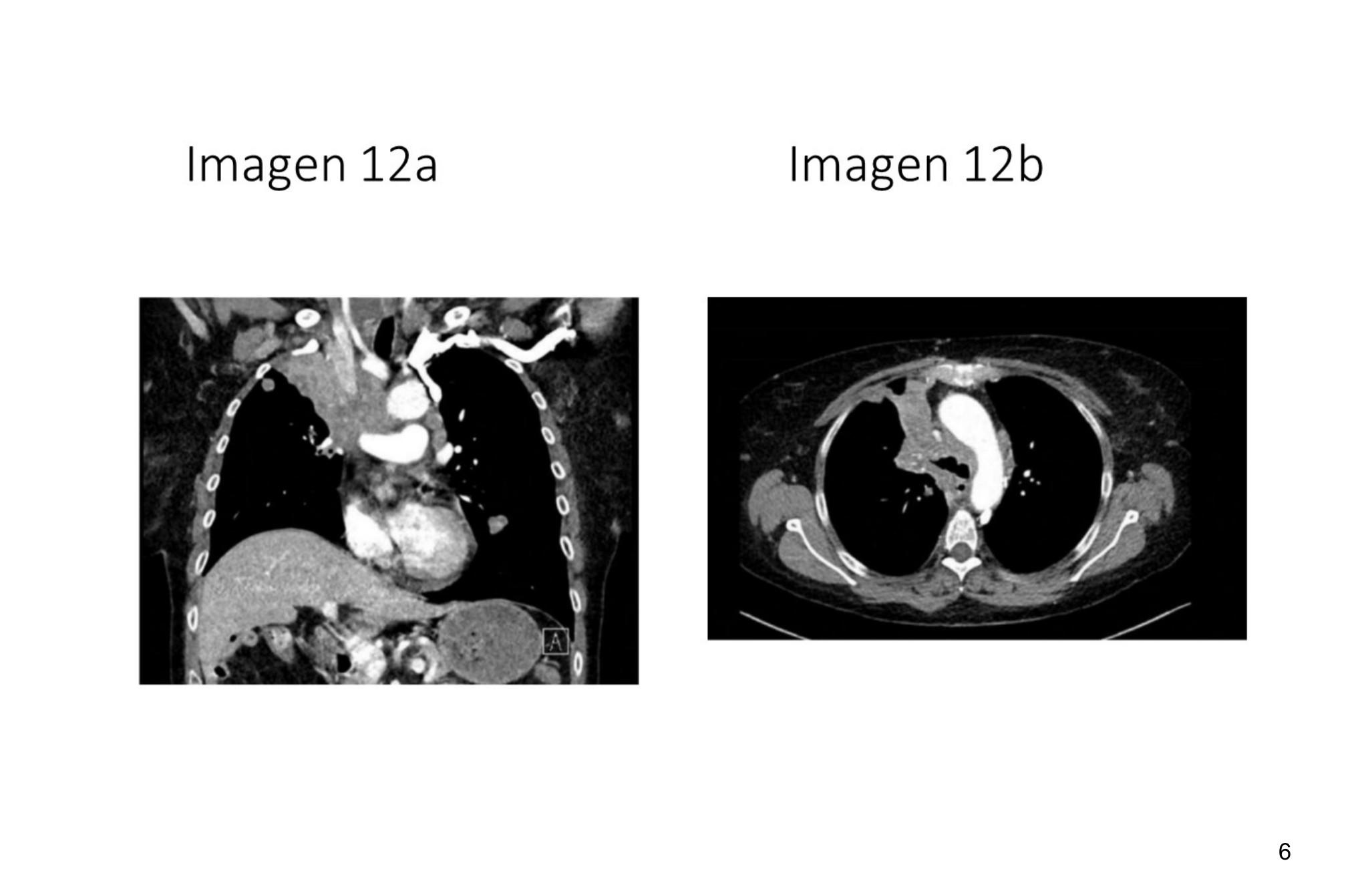 Imagen clínica de la pregunta de Hematología