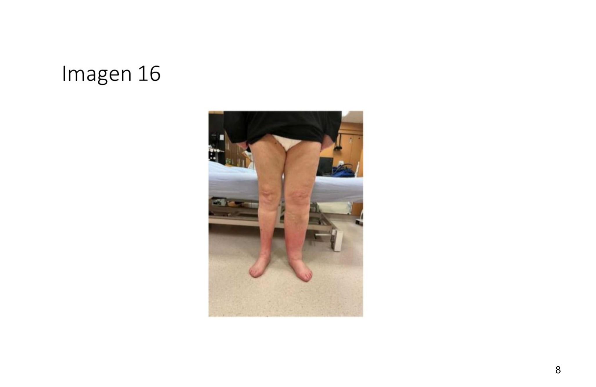 Imagen clínica de la pregunta de Oncología