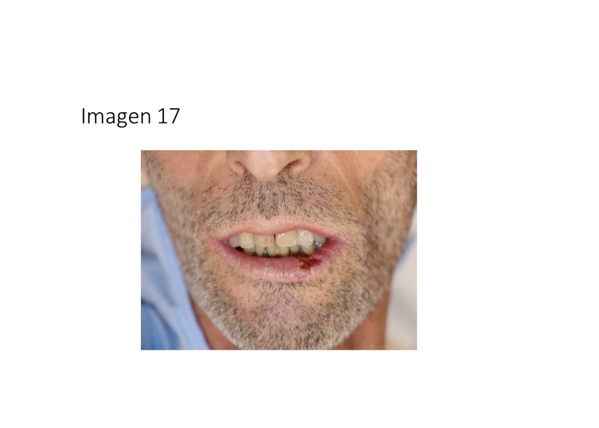 Imagen clínica de la pregunta de Infecciosas