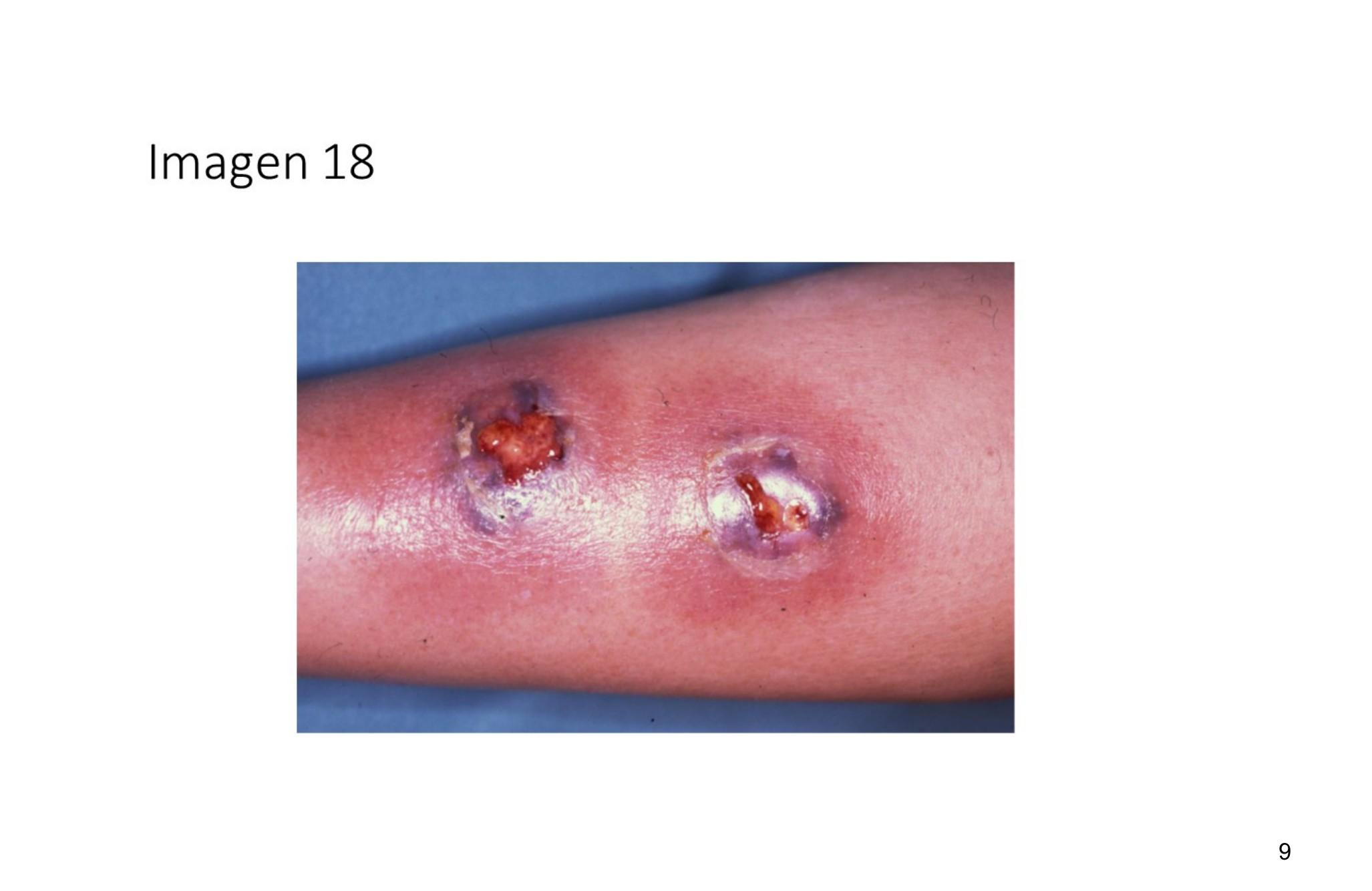 Imagen clínica de la pregunta de Infecciosas