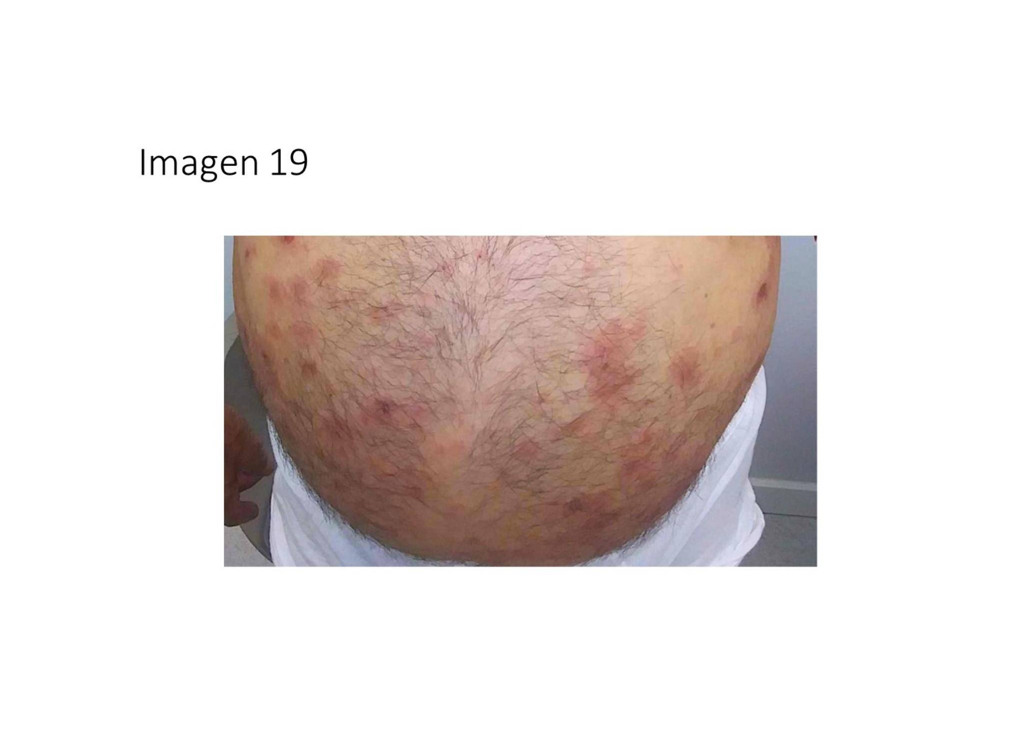 Imagen clínica de la pregunta de Endocrinología