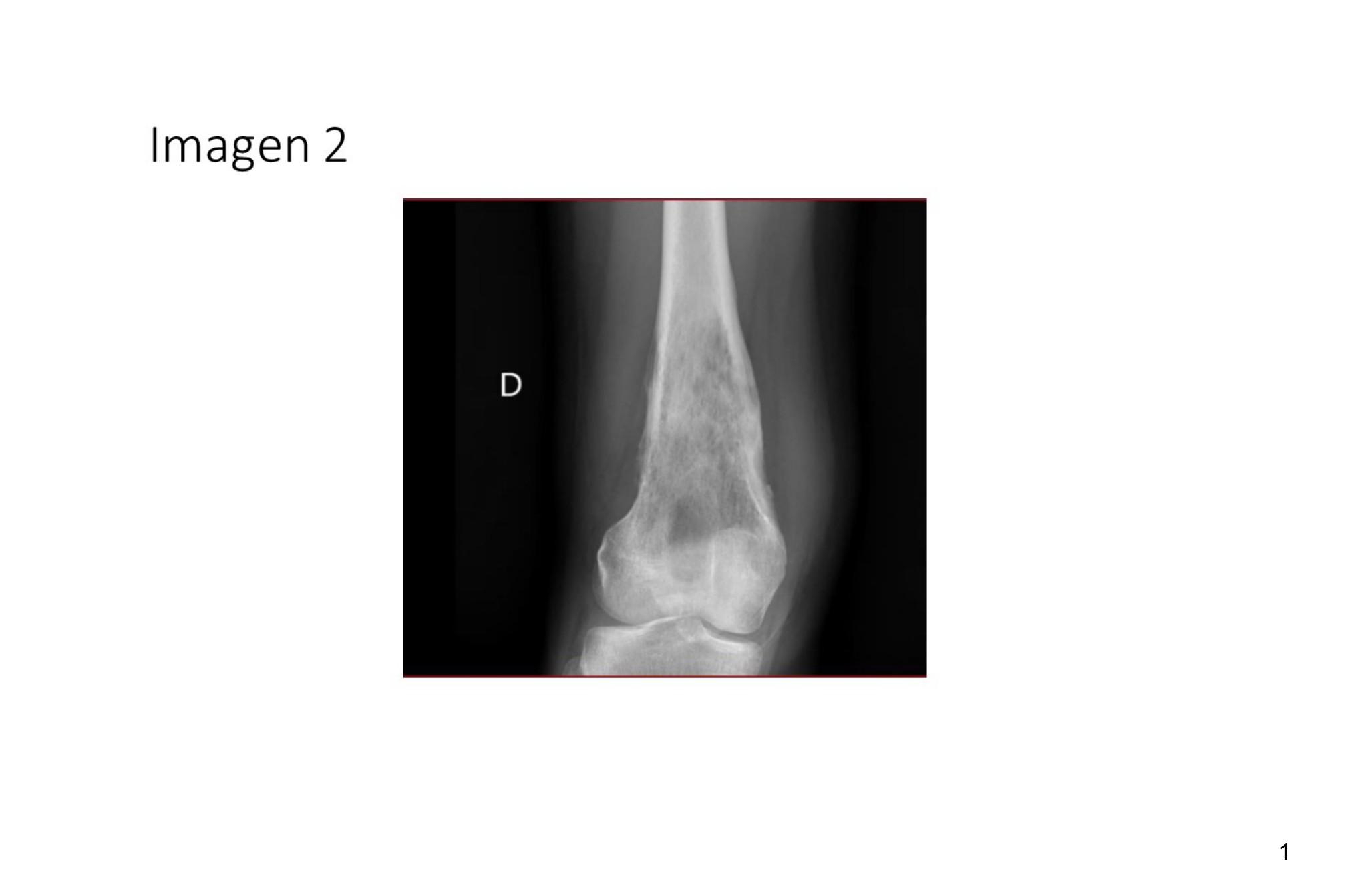 Imagen clínica de la pregunta de Oncología