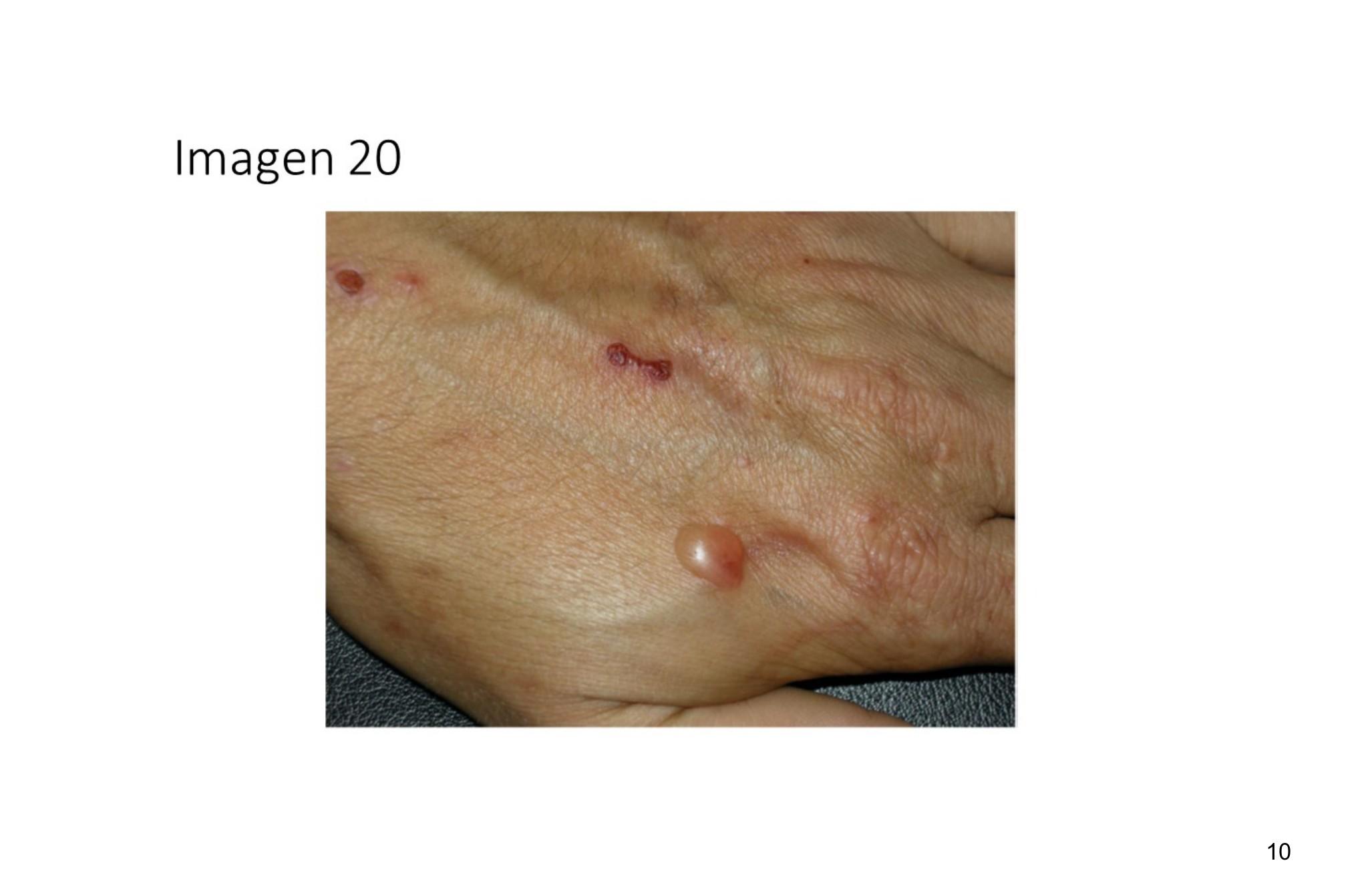 Imagen clínica de la pregunta de Dermatología