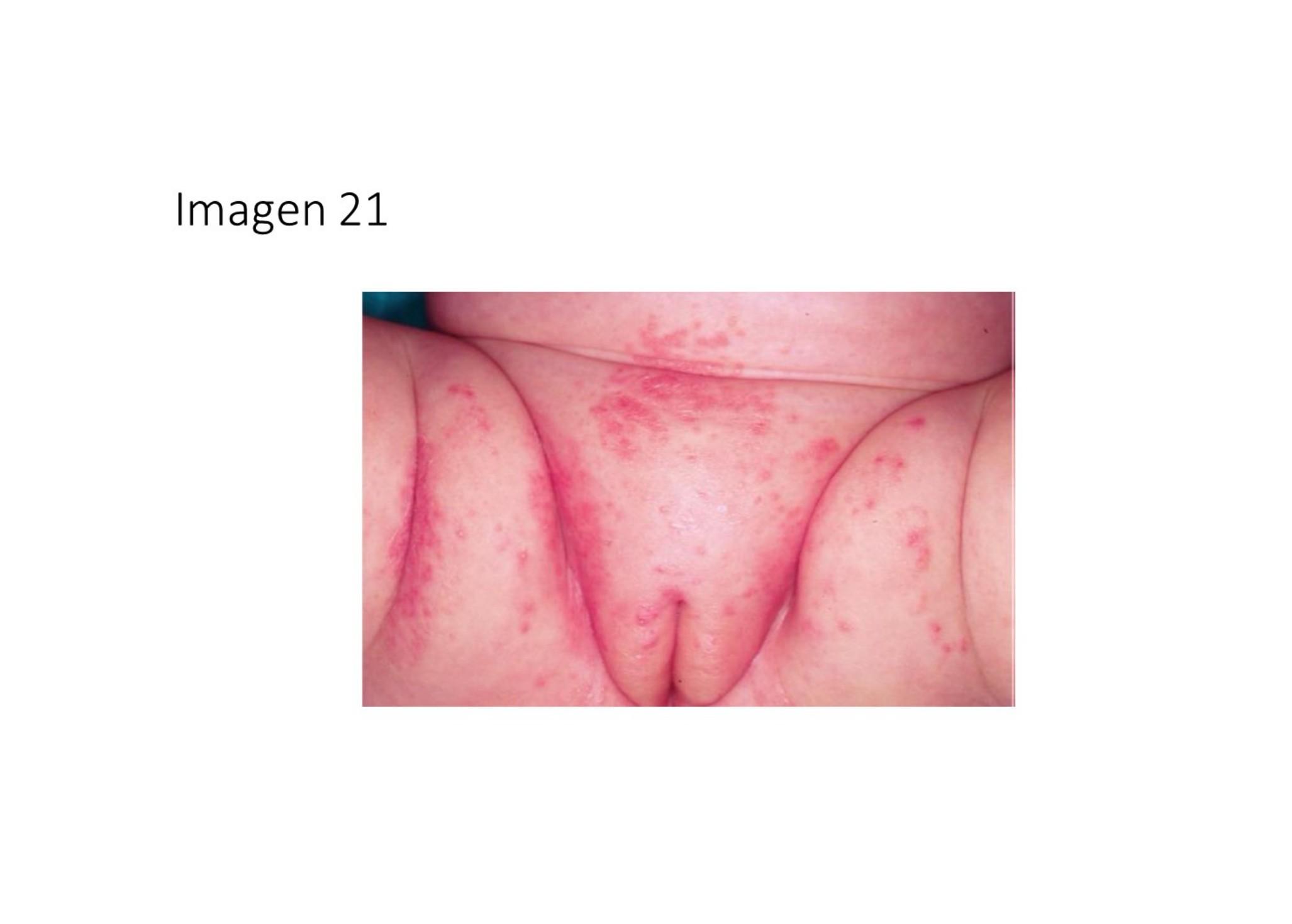 Imagen clínica de la pregunta de Pediatría