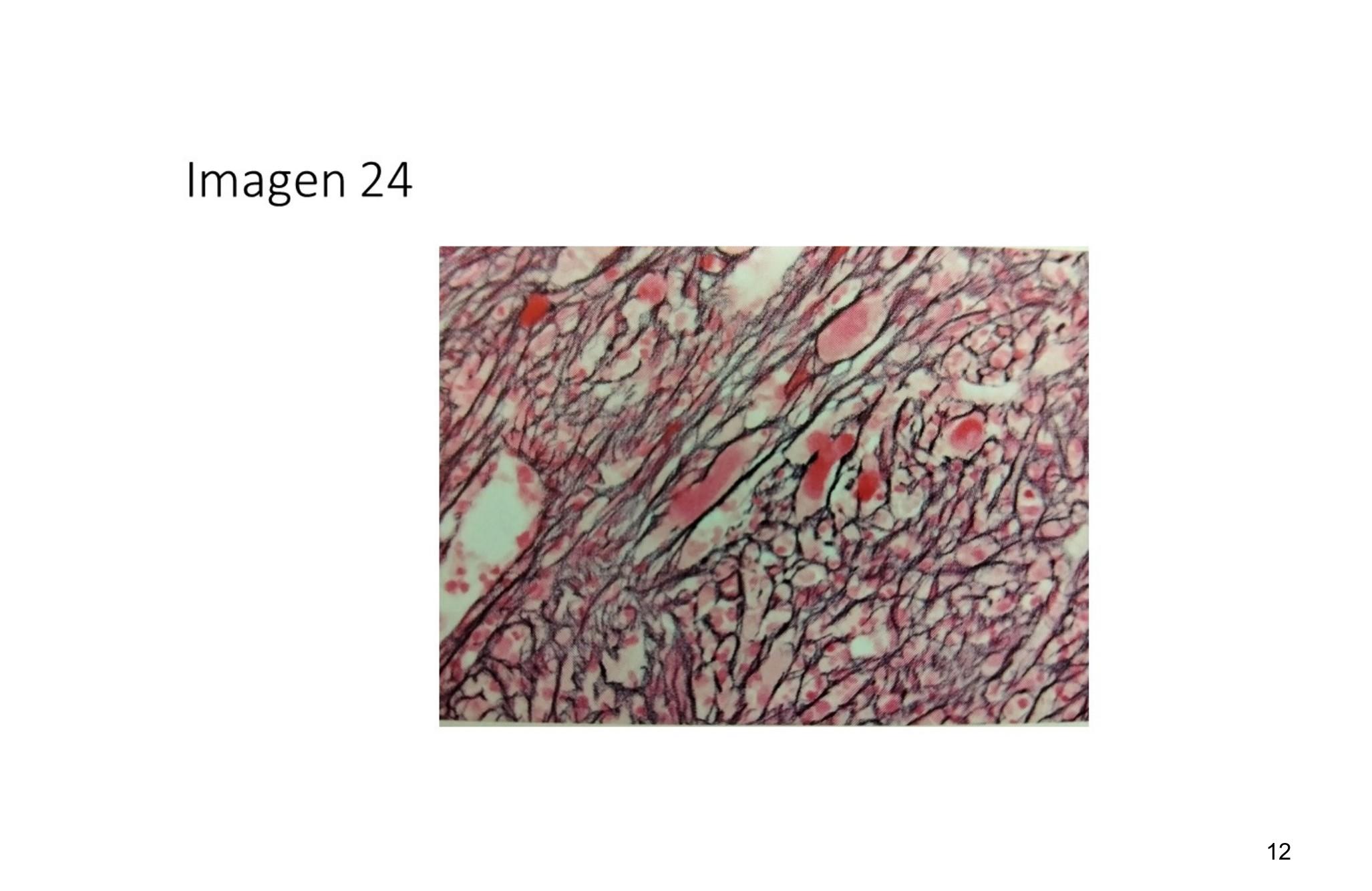 Imagen clínica de la pregunta de Hematología