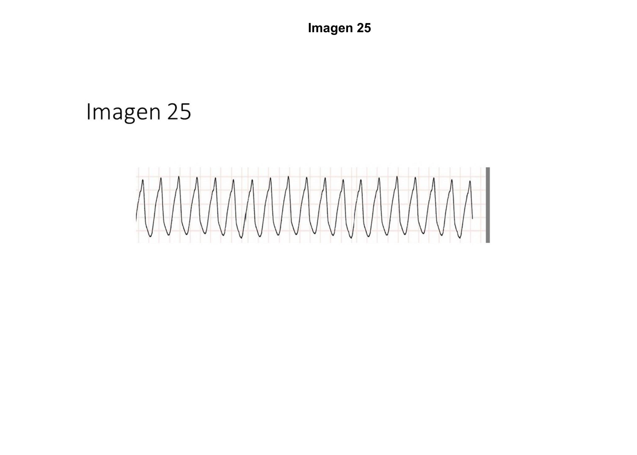 Imagen clínica de la pregunta de Cardiología