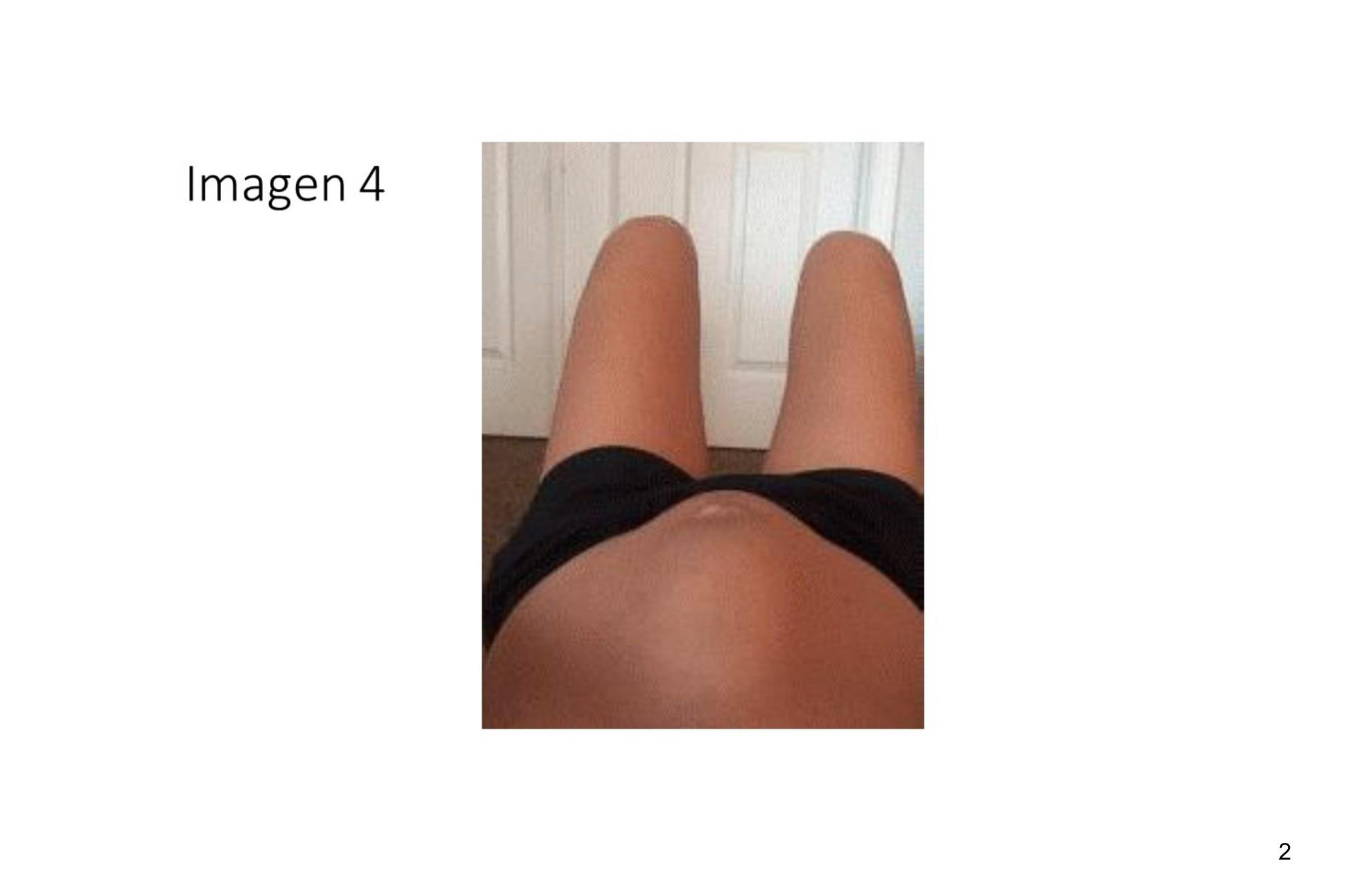 Imagen clínica de la pregunta de Cirugía