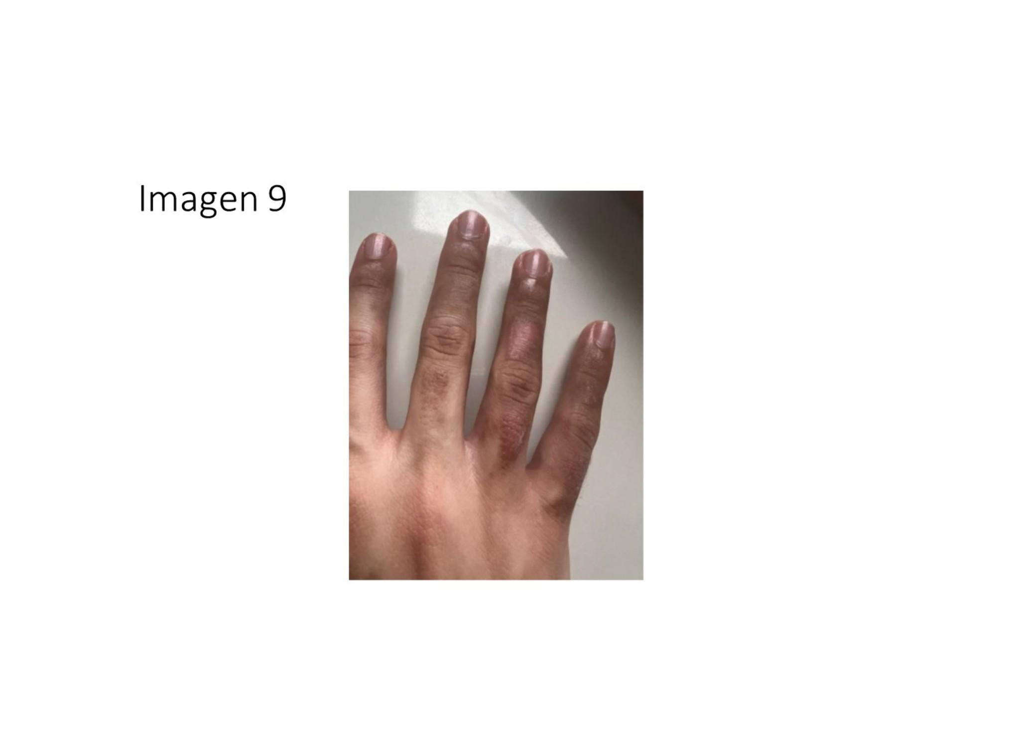 Imagen clínica de la pregunta de Dermatología