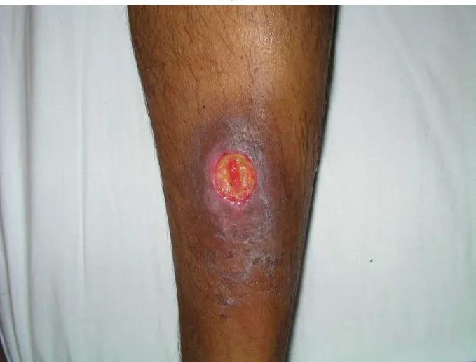 Imagen clínica de la pregunta de Hematología