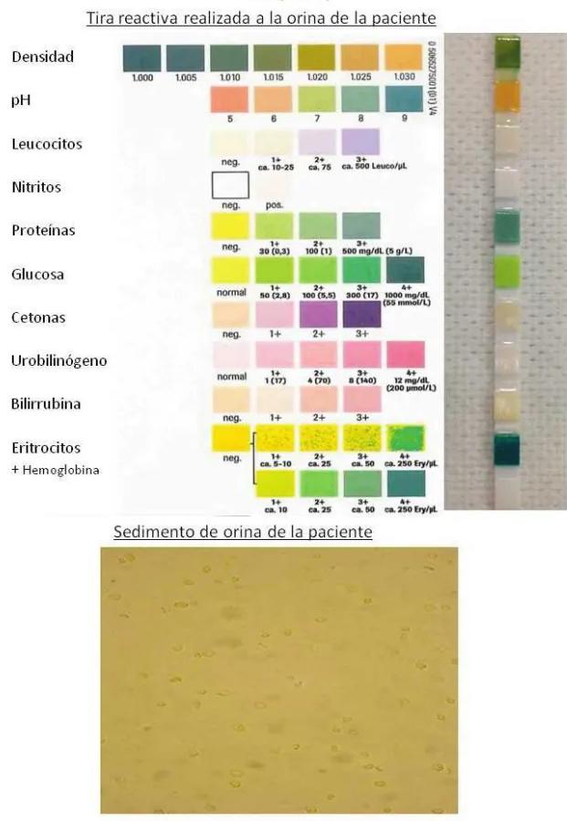 Imagen clínica de la pregunta de Nefrología