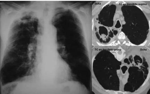Imagen clínica de la pregunta de Respiratorio