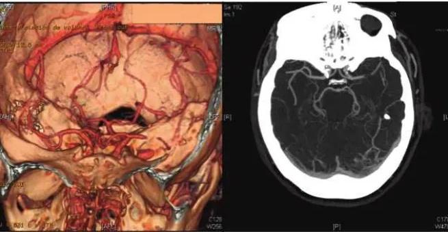 Imagen clínica de la pregunta de Neurología