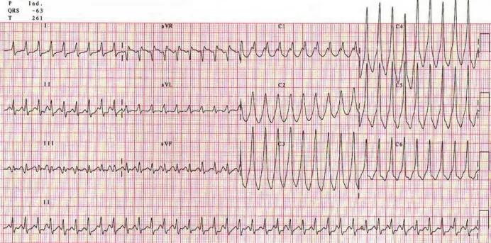 Imagen clínica de la pregunta de Cardiología