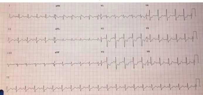 Imagen clínica de la pregunta de Cardiología